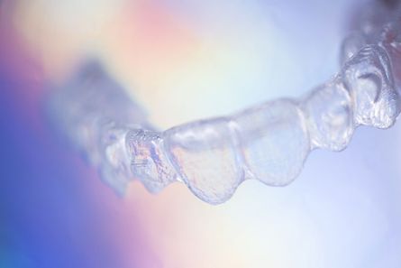 Invisaligne für eine Zahnkorrektur mit unsichtbarer Zahnspange in Wien